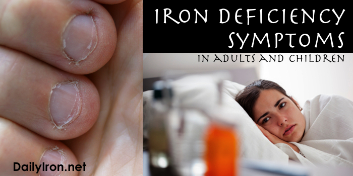 Iron Deficiency Symptoms